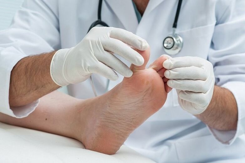 ārsts apskata pēdas ar sēnīti